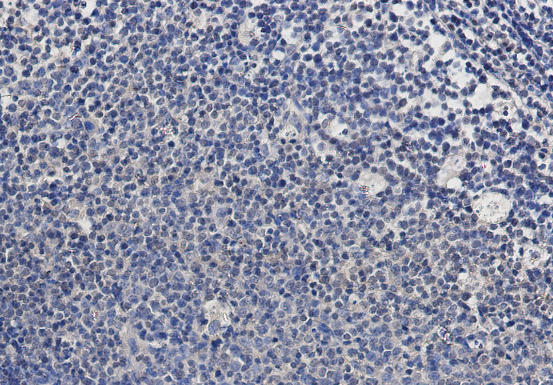 TSG101 Rabbit mAb