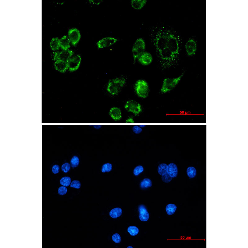 Mitochondrial Fission 1 Protein Rabbit mAb