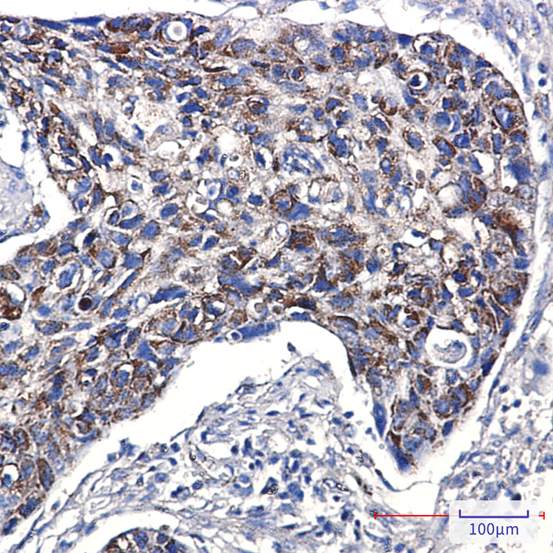 Mitochondrial Fission 1 Protein Rabbit mAb