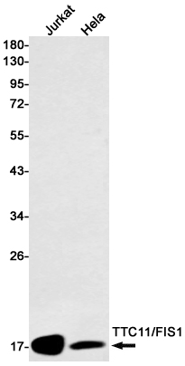 Mitochondrial Fission 1 Protein Rabbit mAb