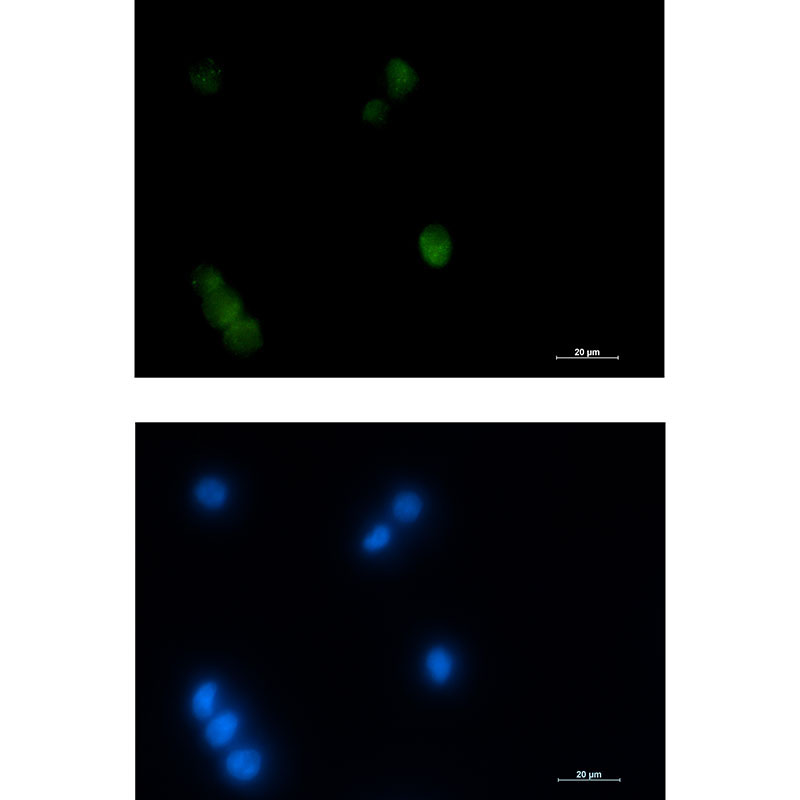 Thyroid Transcription Factor 1 Rabbit mAb