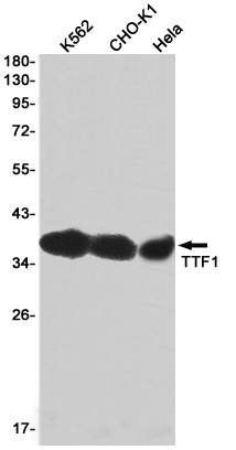 Thyroid Transcription Factor 1 Rabbit mAb