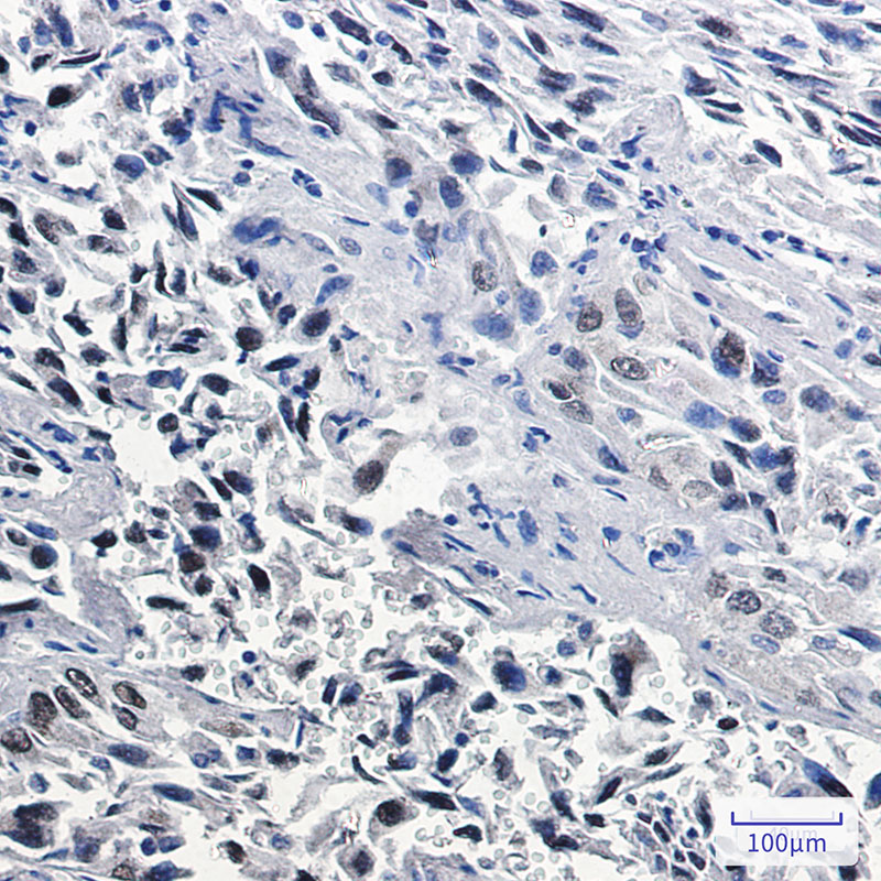 Thyroid Transcription Factor 1 Rabbit mAb