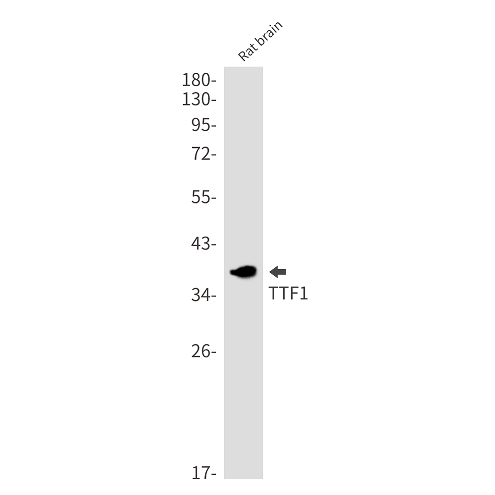 Thyroid Transcription Factor 1 Rabbit mAb