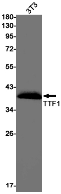 Thyroid Transcription Factor 1 Rabbit mAb