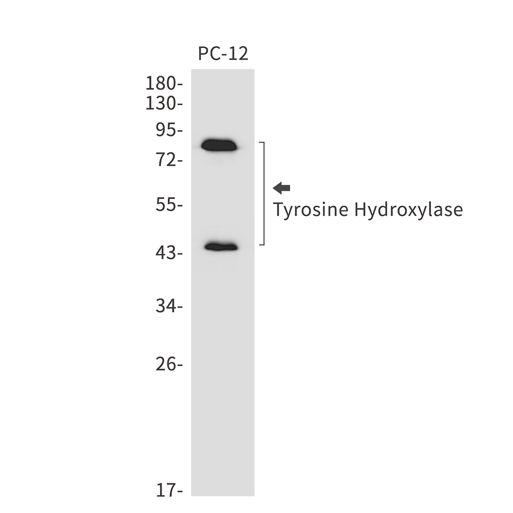 Tyrosine Hydroxylase Rabbit mAb