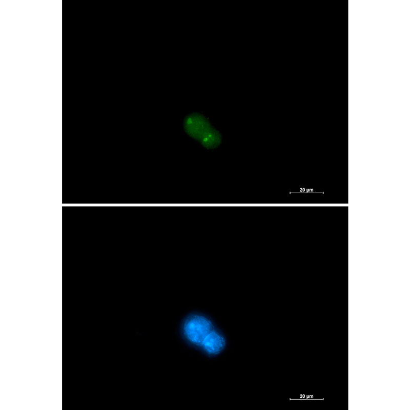 UBA2 Rabbit mAb