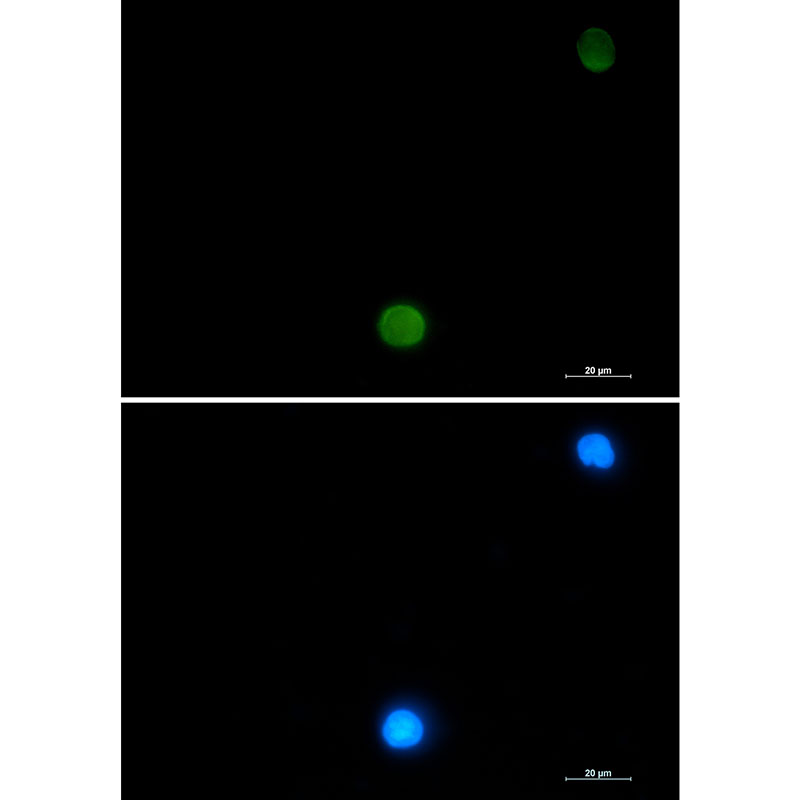 Ubiquitin Rabbit mAb