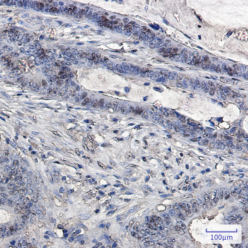 Ubiquitin Rabbit mAb