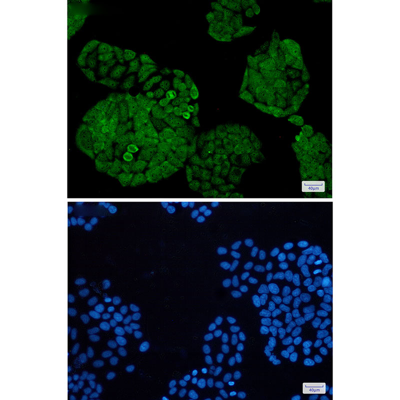 UCHL5 Rabbit mAb