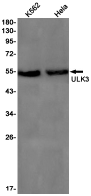 ULK3 Rabbit mAb