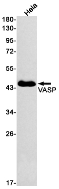 VASP Rabbit mAb