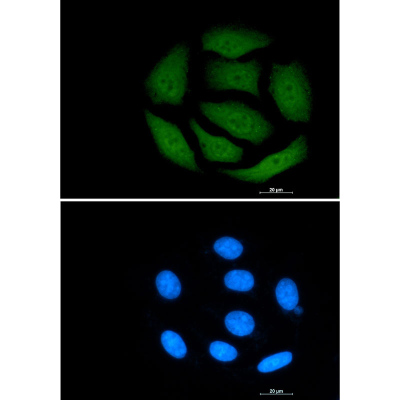 VCP Rabbit mAb