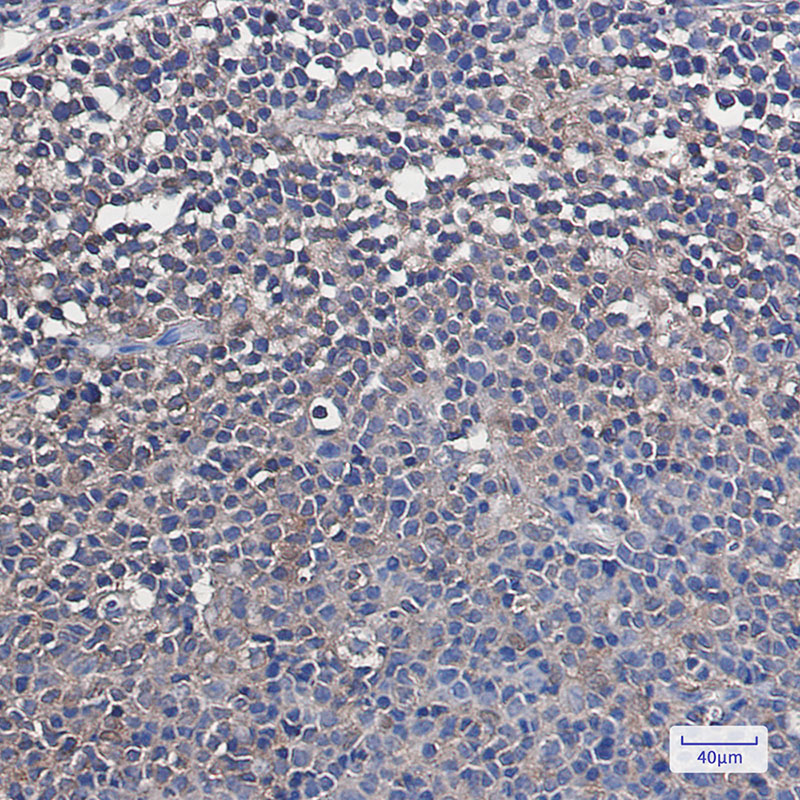 VCP Rabbit mAb