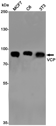 VCP Rabbit mAb