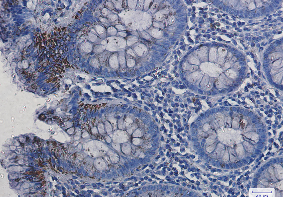 VDAC1 Rabbit mAb