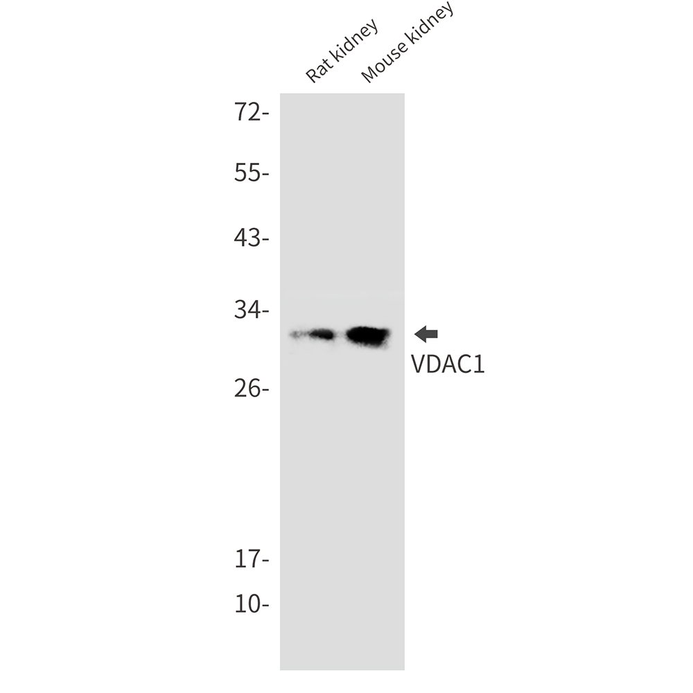 VDAC1 Rabbit mAb