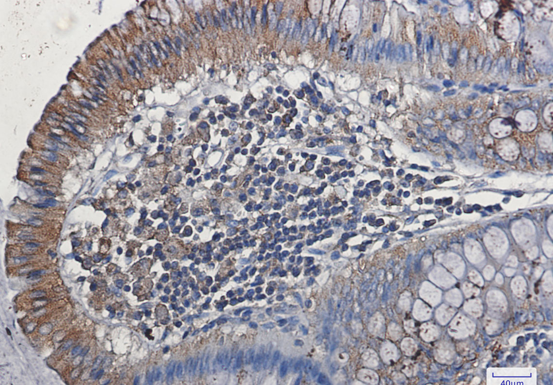 VEGF Receptor 1 Rabbit mAb