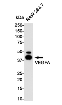 VEGFA Rabbit mAb