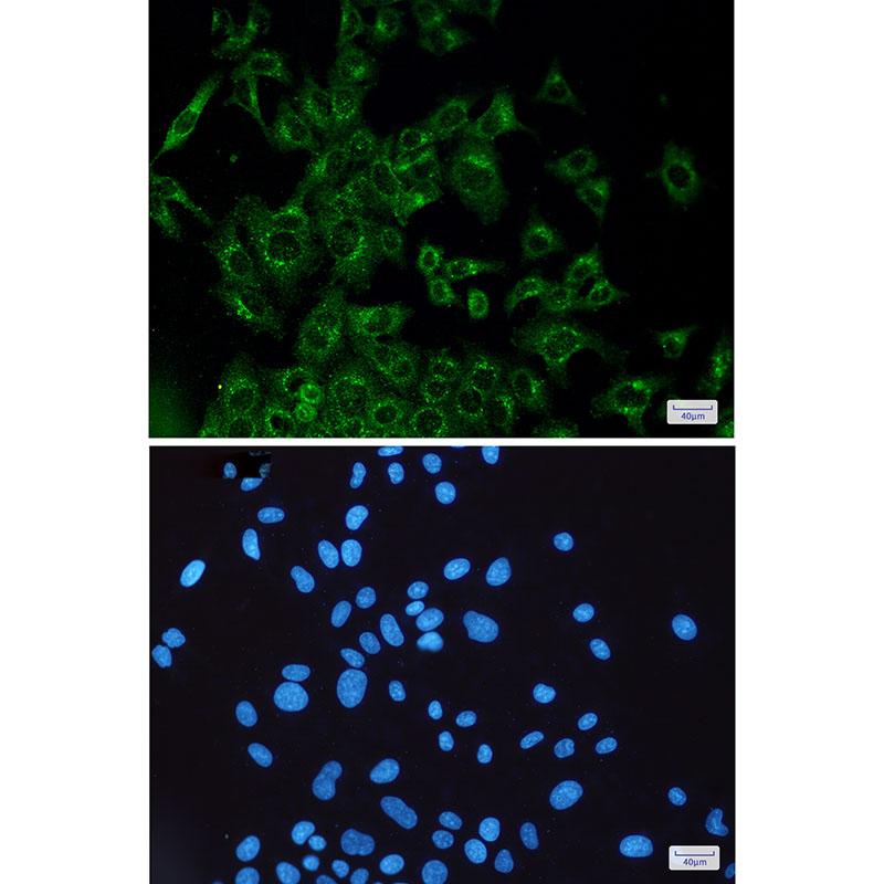 VEGFD Rabbit mAb