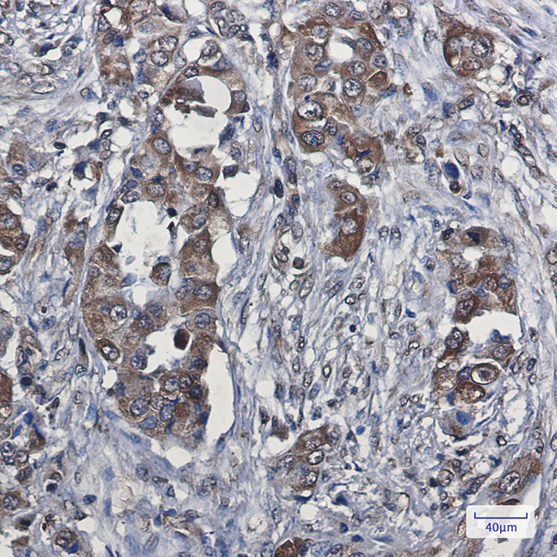 VEGFD Rabbit mAb