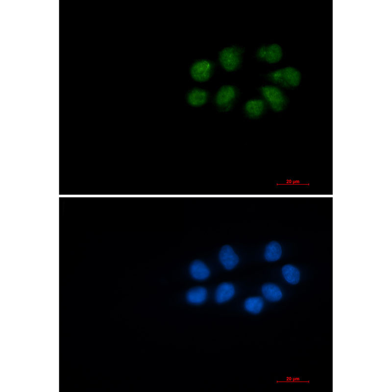 Phospho-Vimentin (Ser56) Rabbit mAb