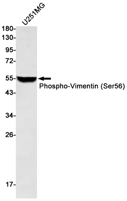 Phospho-Vimentin (Ser56) Rabbit mAb