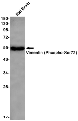 Phospho-Vimentin (Ser72) Rabbit mAb