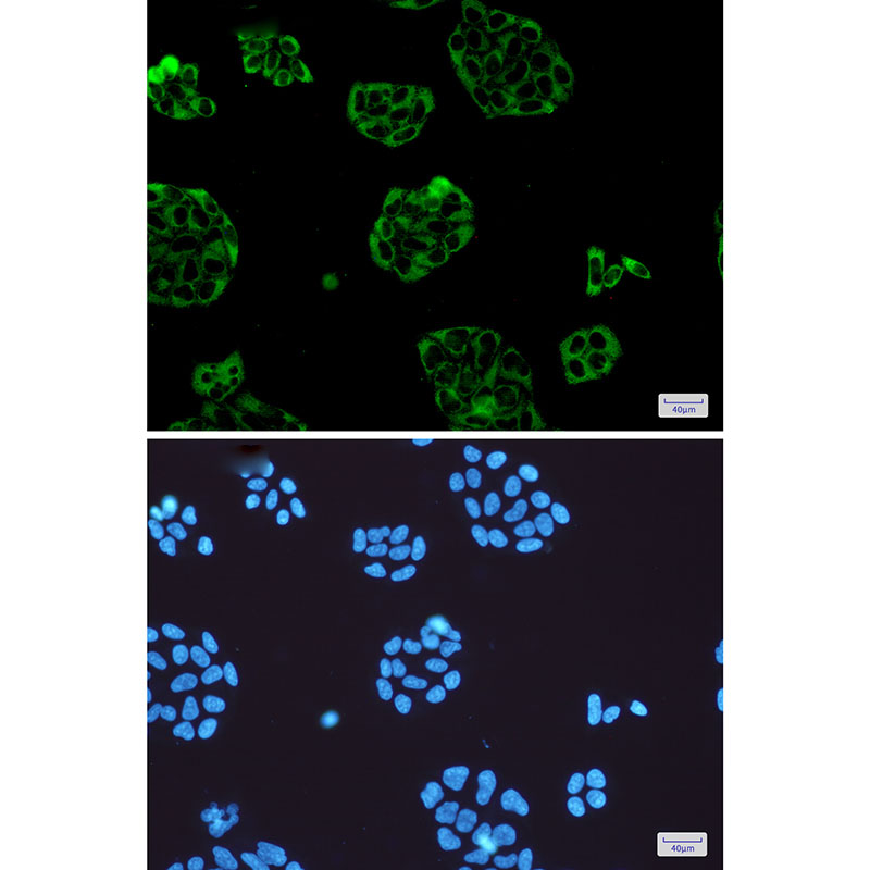 Vinculin Rabbit mAb