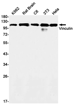 Vinculin Rabbit mAb