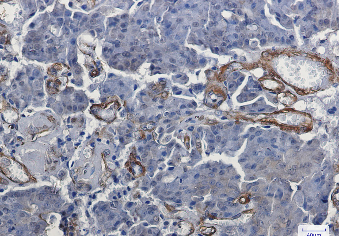 Vinculin Rabbit mAb