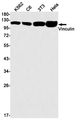 Vinculin Rabbit mAb