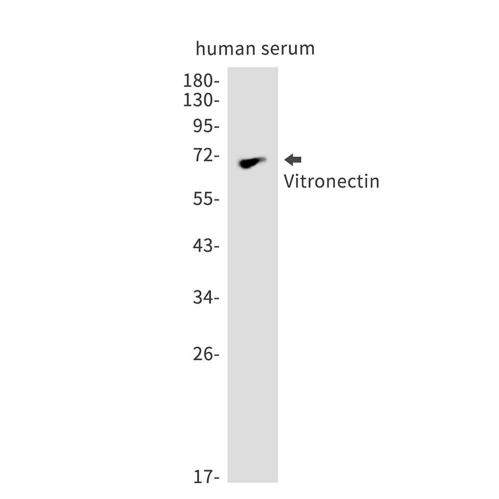 Vitronectin Rabbit mAb