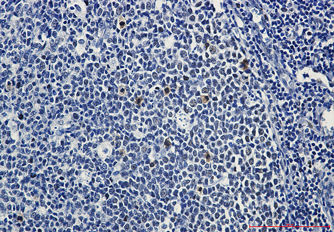 Phospho-c Myb (Ser11) Rabbit mAb