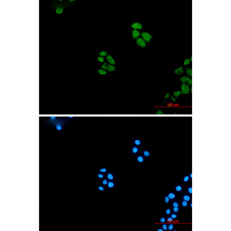 Wnt5a Rabbit mAb