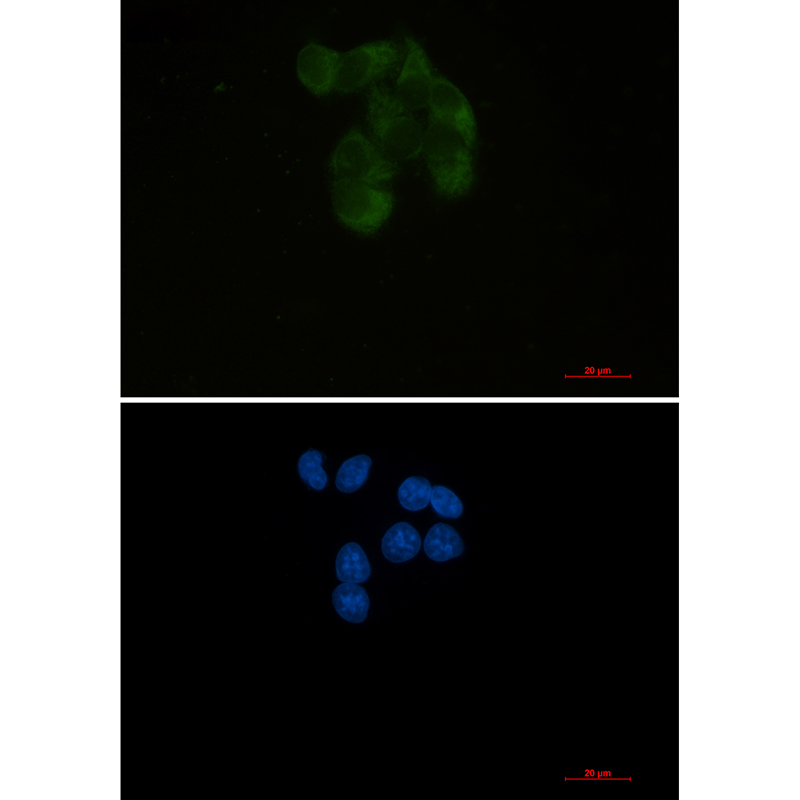 YB1 Rabbit mAb