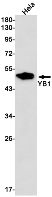 YB1 Rabbit mAb