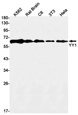 YY1 Rabbit mAb