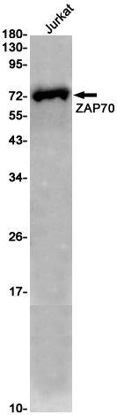 ZAP70 Rabbit mAb