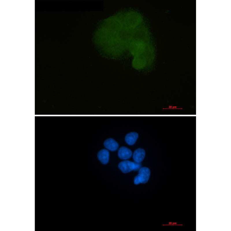 MEK1 Rabbit mAb