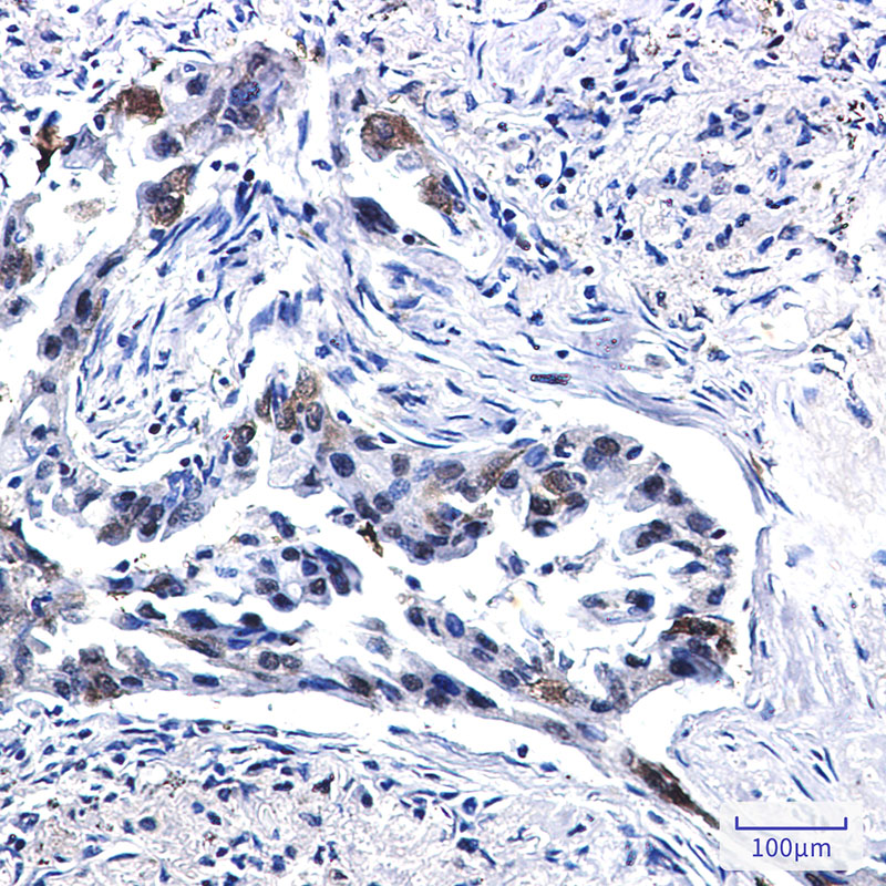 Tissue Factor Rabbit mAb