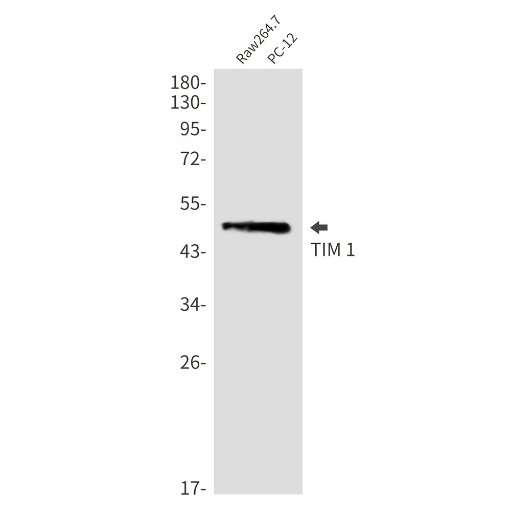 Hepatitis A Virus Cellular Receptor 1 Rabbit mAb