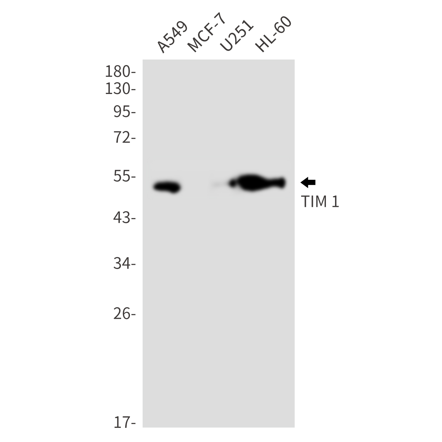 Hepatitis A Virus Cellular Receptor 1 Rabbit mAb