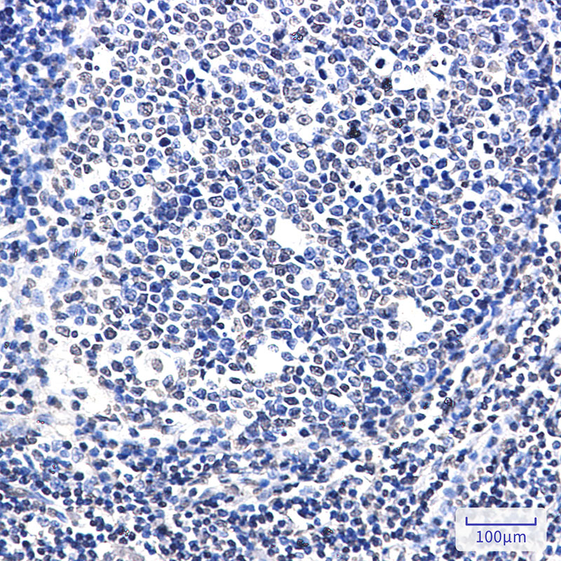 SATB1 Rabbit mAb