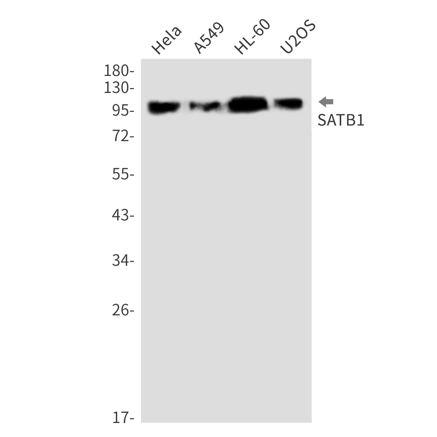 SATB1 Rabbit mAb