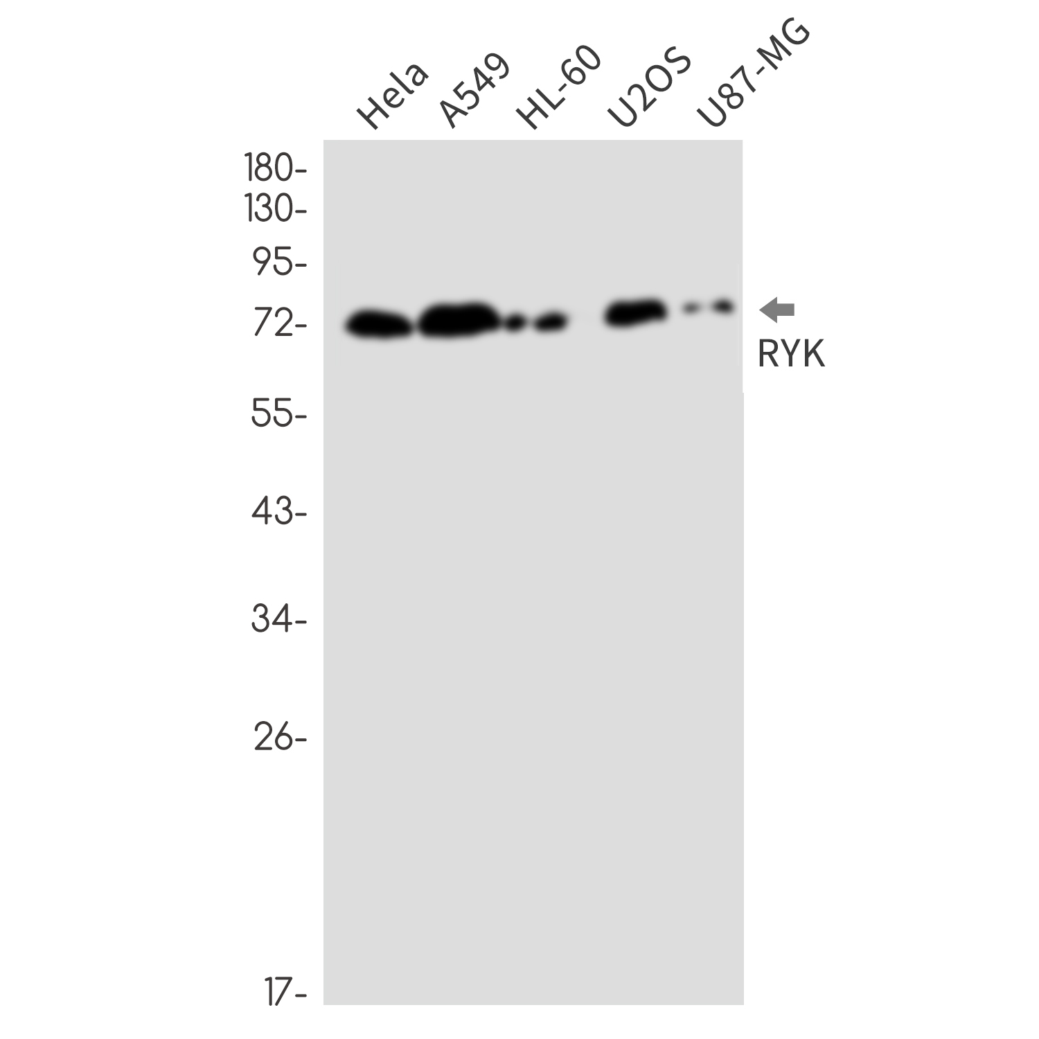 RYK Rabbit mAb