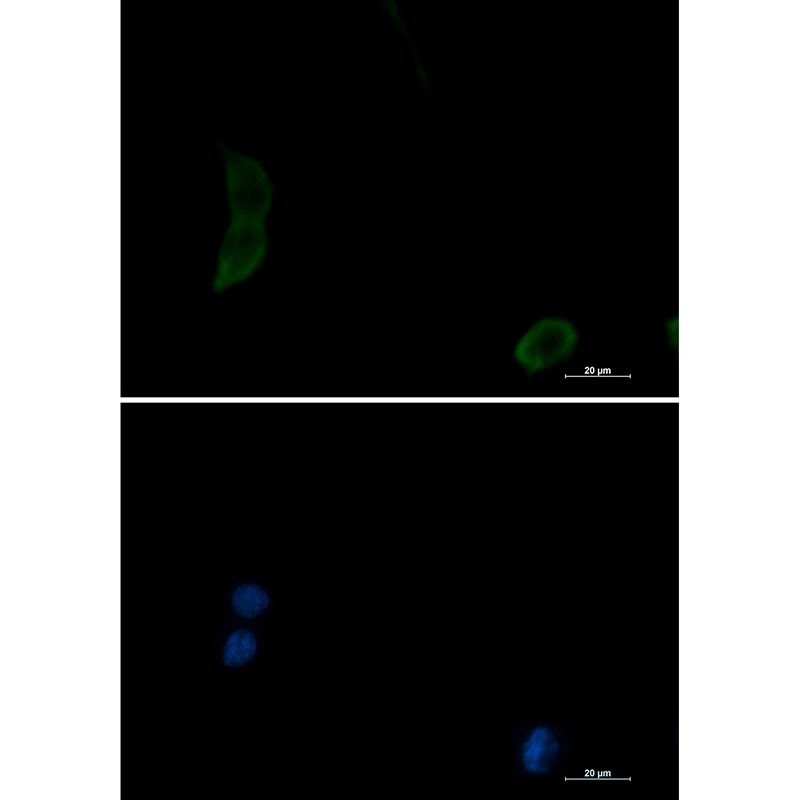 PAK1 Rabbit mAb