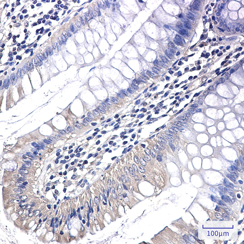 PAK1 Rabbit mAb