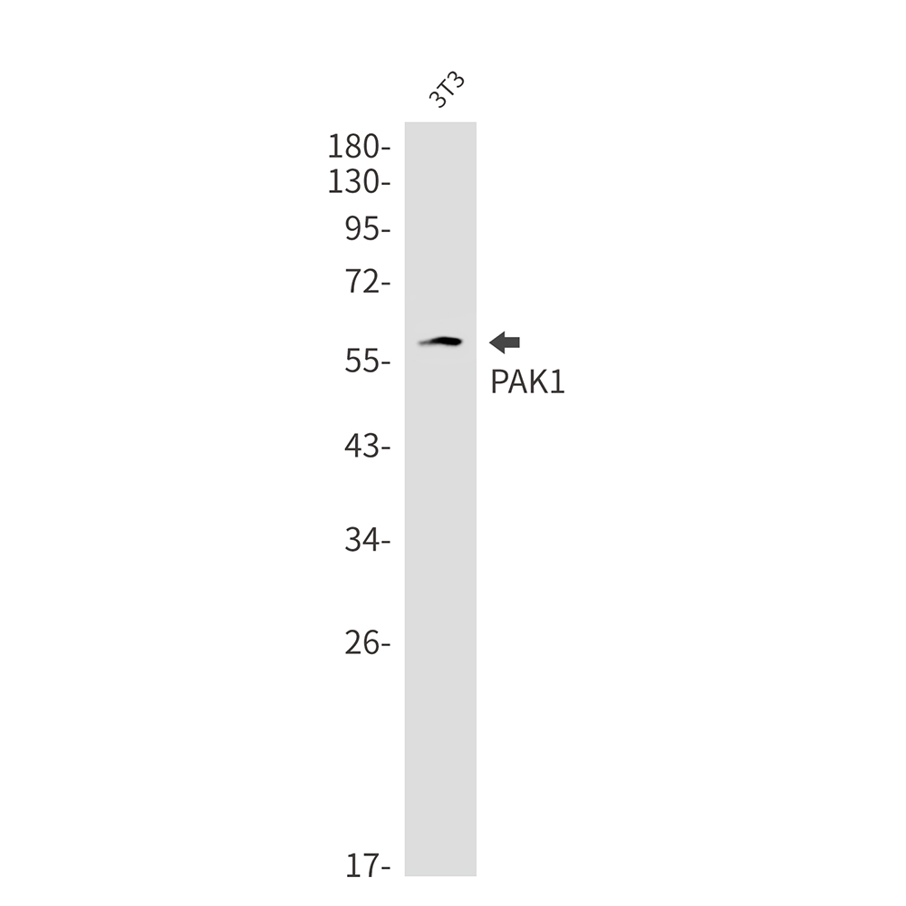 PAK1 Rabbit mAb