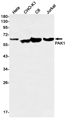 PAK1 Rabbit mAb